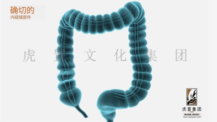 3D医疗动画的制作流程有哪些-虎置动画